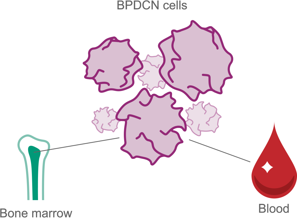 BPDCN cells and how it affects bone marrow and blood